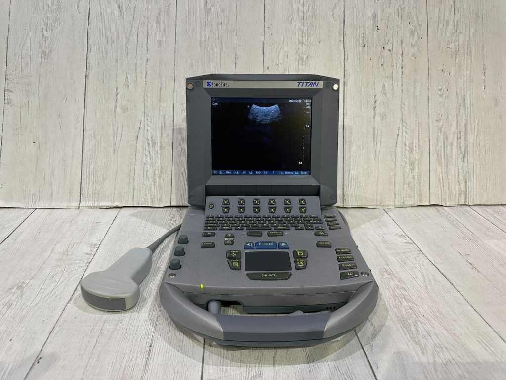 SonoSite Titan Ultrasound Machine With Convex C60 Probe Probe Warranty 6 Months | Ultrasound Machines - Guide & Reviews |