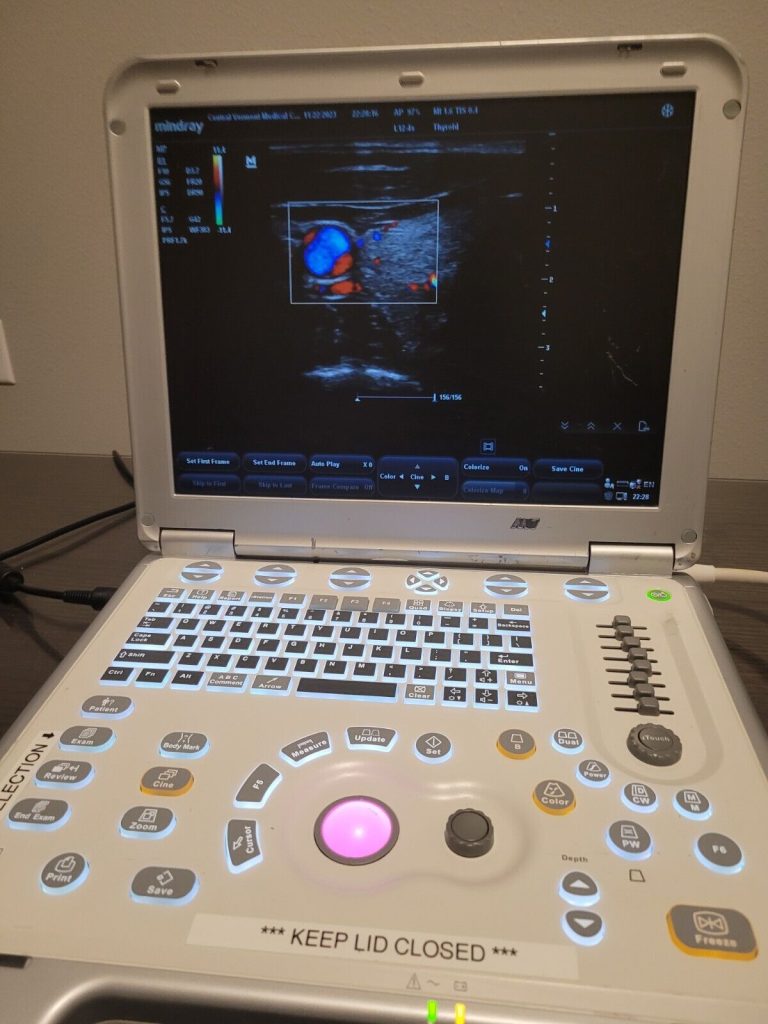 Mindray M7 Portable Ultrasound Machine With 2 Probes, Adapter and Carrying Case | Ultrasound Machines - Guide & Reviews |