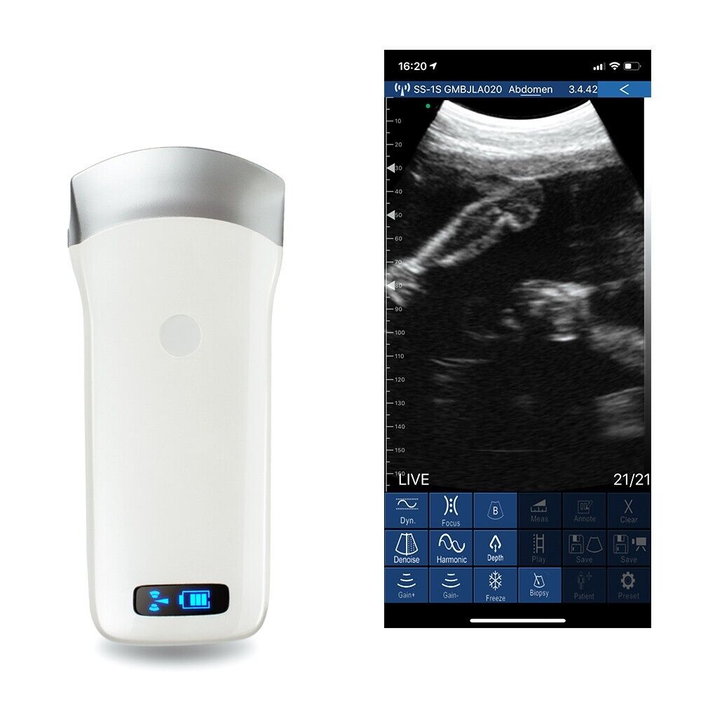 Carejoy Portable WIFI Wireless Ultrasound Scanner Machine + Convex Probe 3.5Mhz | Ultrasound Machines - Guide & Reviews |
