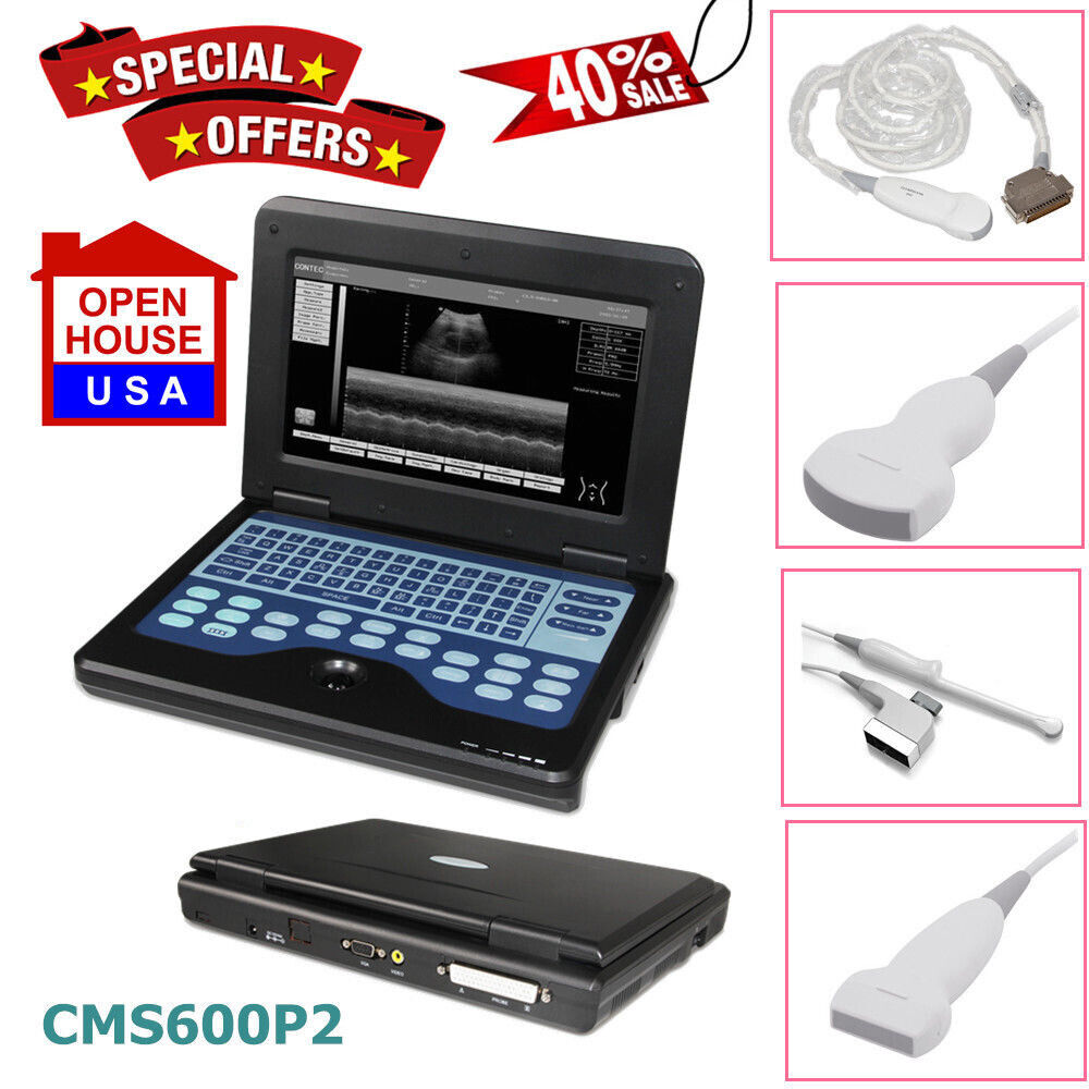 USA,CMS600P2 Portable Ultrasound Scanner Diagnostic Laptop Machine OPTIONAL | Ultrasound Machines - Guide & Reviews |