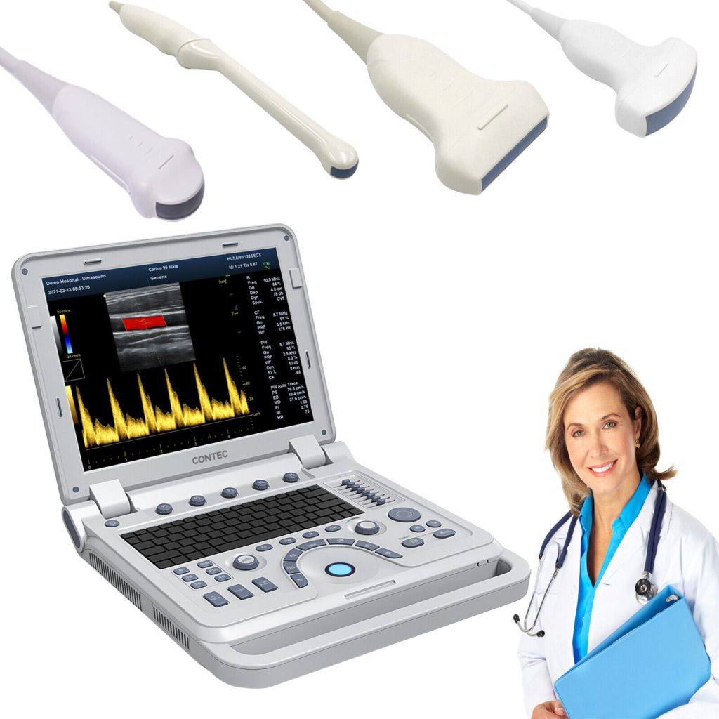 CONTEC CMS1700A Portable Laptop Machine Digital Color Doppler Ultrasound Scanner | Ultrasound Machines - Guide & Reviews |