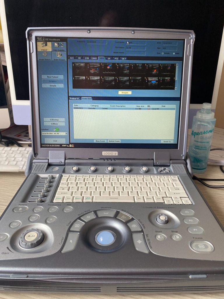 GE LOGIQ e Portable Ultrasound Machine . Working and looks great. | Ultrasound Machines - Guide & Reviews |