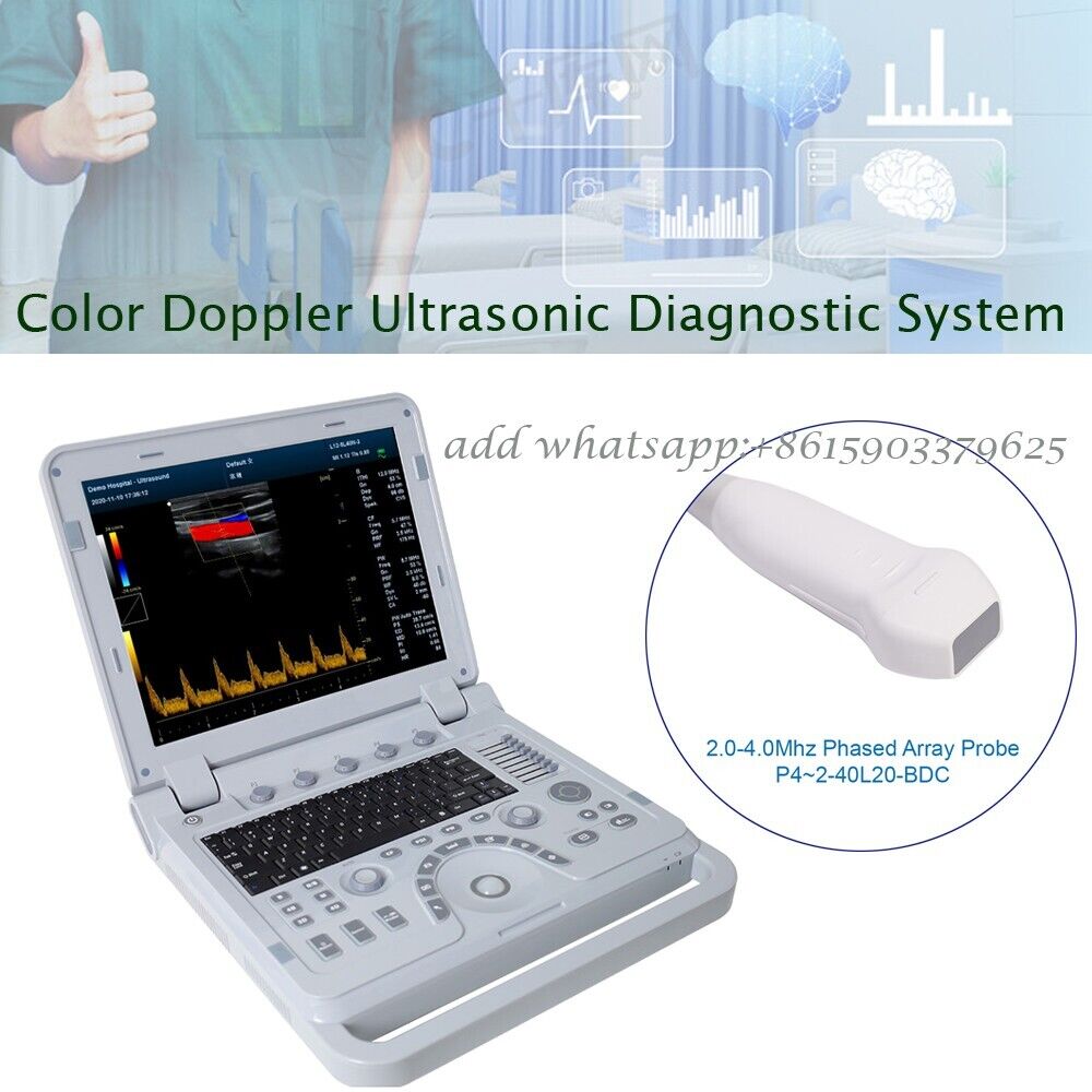 Portable Cardiac Ultrasound Color Doppler Ultrasound Machine+Phased array probe | Ultrasound Machines - Guide & Reviews |