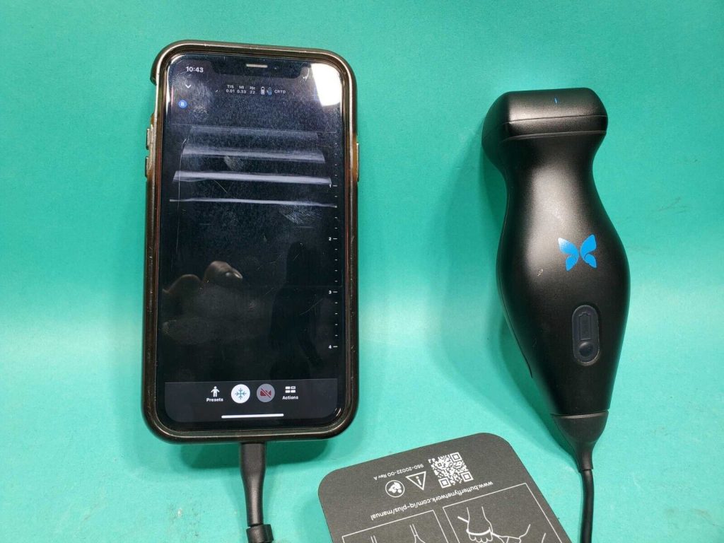 Butterfly IQ+ Portable Ultrasound Machine (Lightning) | Ultrasound Machines - Guide & Reviews |