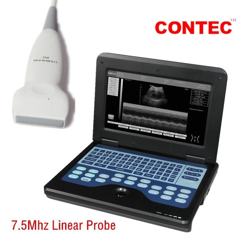 diagnostic sonography Portable Ultrasound Scanner Machine+Linear probe 5.0-10.0M | Ultrasound Machines - Guide & Reviews |