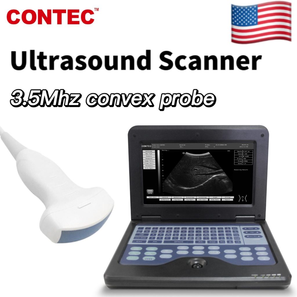 CONTEC CMS600P2 Digital Ultrasound Scanner Laptop Machine 3.5Mhz Convex Probe US | Ultrasound Machines - Guide & Reviews |
