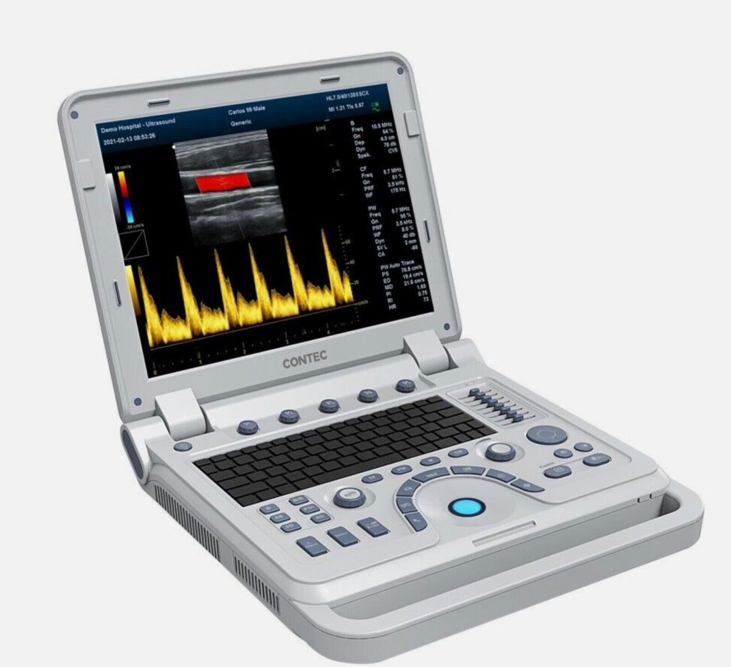 Color Doppler Ultrasound Diagnostic System Machine model CMS1700A with 2 probes | Ultrasound Machines - Guide & Reviews |