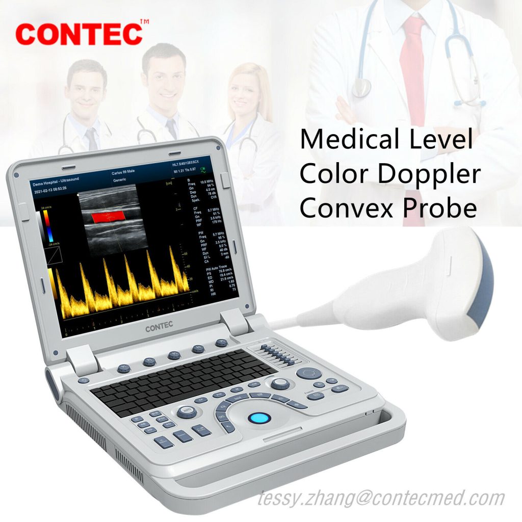 Color Doppler Ultrasonic Diagnostic CF Ultrasound Scanner Machine USG Convex | Ultrasound Machines - Guide & Reviews |