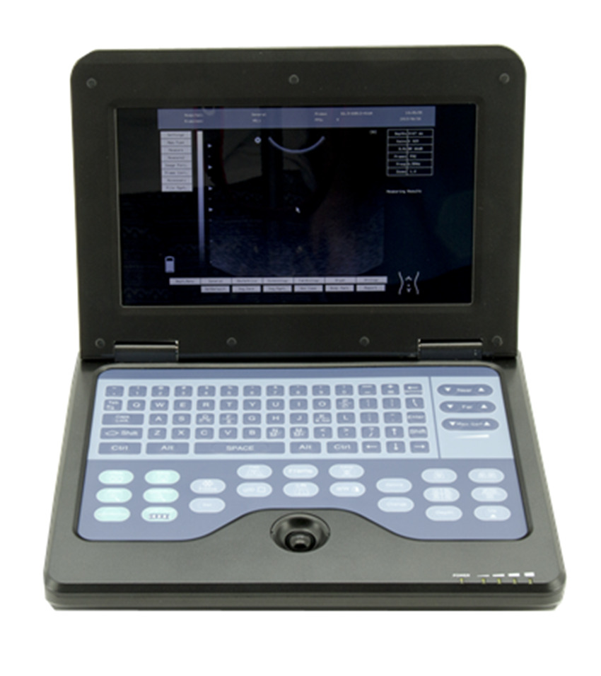 CONTEC CMS600P2 Portable Laptop Machine B-Ultrasound Scanner Linear Probe | Ultrasound Machines - Guide & Reviews |
